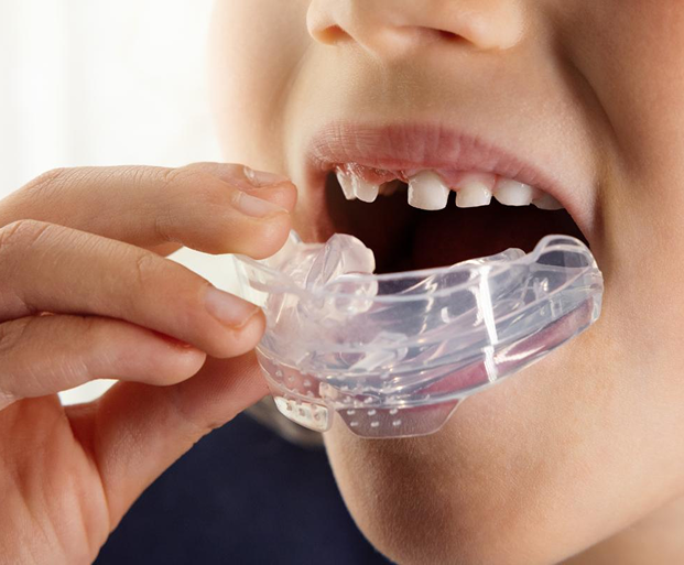 Sports Mouthguards for Children in Indore