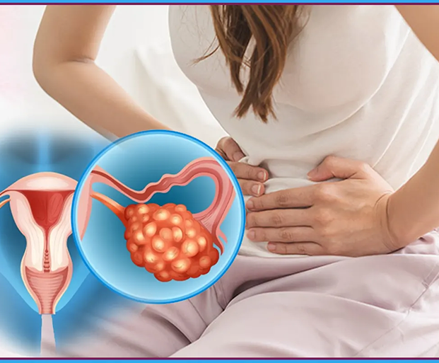 PCOD - PCOS Treatment in Indore